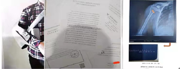 北京市西单大悦城恶势力故意殴打残疾人至轻伤事实真相